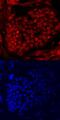 PR/SET Domain 14 antibody, MA5-24292, Invitrogen Antibodies, Immunocytochemistry image 