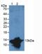 S100 Calcium Binding Protein A9 antibody, LS-C710358, Lifespan Biosciences, Western Blot image 