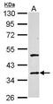 Galectin 4 antibody, GTX127351, GeneTex, Western Blot image 