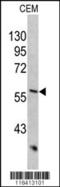 Keratin 10 antibody, MBS9205296, MyBioSource, Western Blot image 