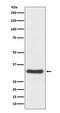 QR1 antibody, M00494, Boster Biological Technology, Western Blot image 