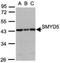 SMYD Family Member 5 antibody, NBP1-31222, Novus Biologicals, Western Blot image 