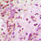 Heterogeneous Nuclear Ribonucleoprotein A2/B1 antibody, LS-C356104, Lifespan Biosciences, Immunohistochemistry paraffin image 
