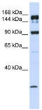 ATP Binding Cassette Subfamily A Member 5 antibody, TA331848, Origene, Western Blot image 