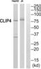 CAP-Gly Domain Containing Linker Protein Family Member 4 antibody, abx014302, Abbexa, Western Blot image 