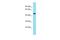 Family With Sequence Similarity 221 Member B antibody, A17949, Boster Biological Technology, Western Blot image 