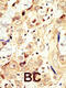 HER4 antibody, 63-072, ProSci, Immunohistochemistry paraffin image 