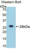 T Cell Immunoreceptor With Ig And ITIM Domains antibody, LS-C296581, Lifespan Biosciences, Western Blot image 