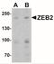 Zinc Finger E-Box Binding Homeobox 2 antibody, NBP1-77179, Novus Biologicals, Western Blot image 