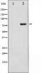 MYB Proto-Oncogene, Transcription Factor antibody, TA325700, Origene, Western Blot image 