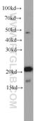 KRAS Proto-Oncogene, GTPase antibody, 16155-1-AP, Proteintech Group, Western Blot image 