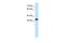 SAP30 Binding Protein antibody, PA5-40861, Invitrogen Antibodies, Western Blot image 