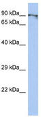 BEN Domain Containing 2 antibody, TA337841, Origene, Western Blot image 