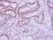 Sorbin And SH3 Domain Containing 3 antibody, LS-C155413, Lifespan Biosciences, Immunohistochemistry frozen image 