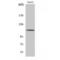 CAP-Gly Domain Containing Linker Protein 2 antibody, LS-C382756, Lifespan Biosciences, Western Blot image 