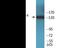 Insulin Receptor Substrate 1 antibody, EKC2049, Boster Biological Technology, Western Blot image 