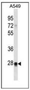 Ras Like Without CAAX 2 antibody, AP53671PU-N, Origene, Western Blot image 