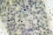 LIM Domain Kinase 2 antibody, LS-C177921, Lifespan Biosciences, Immunohistochemistry paraffin image 