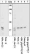NFKB Inhibitor Alpha antibody, GTX25682, GeneTex, Western Blot image 