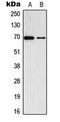 AarF Domain Containing Kinase 2 antibody, LS-C354220, Lifespan Biosciences, Western Blot image 