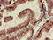 TAR DNA Binding Protein antibody, LS-C679727, Lifespan Biosciences, Immunohistochemistry paraffin image 