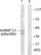 Heterogeneous Nuclear Ribonucleoprotein C (C1/C2) antibody, LS-C199070, Lifespan Biosciences, Western Blot image 