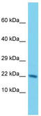 Nudix Hydrolase 3 antibody, TA332026, Origene, Western Blot image 