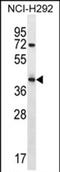 Arrestin Domain Containing 5 antibody, PA5-71704, Invitrogen Antibodies, Western Blot image 