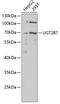 UDP Glucuronosyltransferase Family 2 Member B7 antibody, GTX32950, GeneTex, Western Blot image 