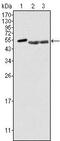 Protein Tyrosine Kinase 6 antibody, MA5-15328, Invitrogen Antibodies, Western Blot image 