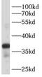Beta-1,4-Galactosyltransferase 7 antibody, FNab00777, FineTest, Western Blot image 