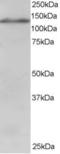 Ubiquitin Specific Peptidase 11 antibody, EB05984, Everest Biotech, Western Blot image 