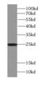 Ras-related protein Rab-3A antibody, FNab07025, FineTest, Western Blot image 
