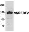 Sterol Regulatory Element Binding Transcription Factor 2 antibody, A01678, Boster Biological Technology, Western Blot image 