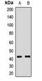 ATPase Na+/K+ Transporting Subunit Beta 2 antibody, LS-C668030, Lifespan Biosciences, Western Blot image 