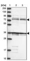 Katanin Regulatory Subunit B1 antibody, PA5-59462, Invitrogen Antibodies, Western Blot image 