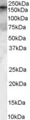 Fibronectin Type III And SPRY Domain Containing 1 antibody, 45-639, ProSci, Enzyme Linked Immunosorbent Assay image 