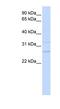 Transmembrane Protein 126B antibody, NBP1-59768, Novus Biologicals, Western Blot image 