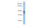 FKBP Prolyl Isomerase 8 antibody, 30-245, ProSci, Enzyme Linked Immunosorbent Assay image 