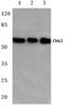 Checkpoint Kinase 2 antibody, AP06051PU-N, Origene, Western Blot image 