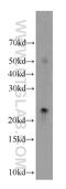 Cancer/Testis Antigen 1B antibody, 19521-1-AP, Proteintech Group, Western Blot image 