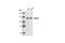 BUB1 Mitotic Checkpoint Serine/Threonine Kinase B antibody, 4116S, Cell Signaling Technology, Western Blot image 