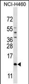 SMCP antibody, PA5-48460, Invitrogen Antibodies, Western Blot image 