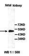 Angiotensin II Receptor Associated Protein antibody, orb77419, Biorbyt, Western Blot image 