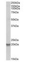 BCL2A1 antibody, orb125052, Biorbyt, Western Blot image 