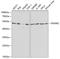 Interferon Alpha And Beta Receptor Subunit 2 antibody, A1769, ABclonal Technology, Western Blot image 