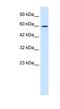 GIOT3 antibody, NBP1-80116, Novus Biologicals, Western Blot image 