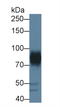 ADAM Metallopeptidase Domain 22 antibody, LS-C373717, Lifespan Biosciences, Western Blot image 