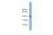 NK2 Homeobox 3 antibody, A09210, Boster Biological Technology, Western Blot image 