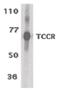 Interleukin 27 Receptor Subunit Alpha antibody, LS-B574, Lifespan Biosciences, Western Blot image 